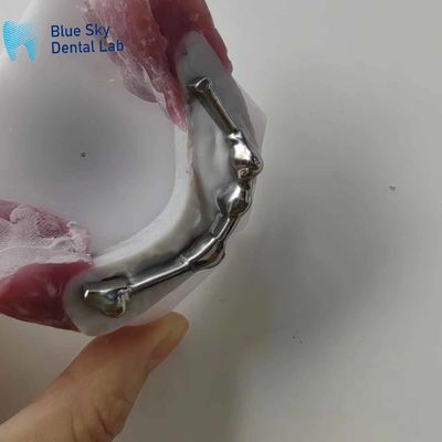 Купить Настраиваемая зубная титановая штанга с зубами для зубных протезов online manufacture