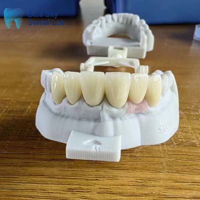 Купить Высокопрозрачные круны из цирконии с натуральными имплантатами online manufacture