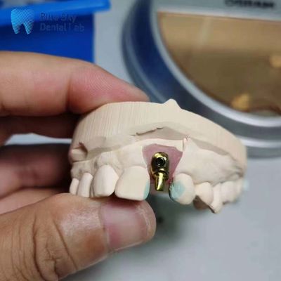 Купить Регулярные корпуса имплантатов настраиваемые одиночные имплантаты зубные Оффсетные арки Имплантаты корпус online manufacture
