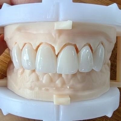 Купить Природный эстетический слоистый цирконовый кроновый мост для красивой улыбки и хорошей реставрации FDA и CE сертификация online manufacture
