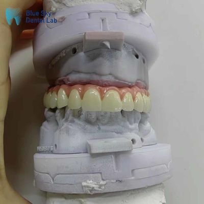 Природа Искусственные зубные имплантаты