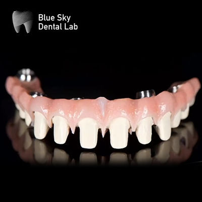 Настраиваемый чистый титановый зубной имплантат с мостом Malo Blue Sky
